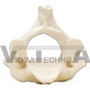 Axis cervical vertebrae model, (no stand)